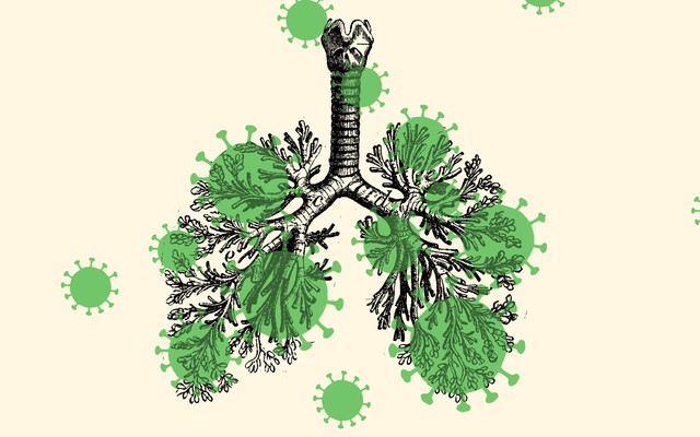 a lung overlaid with silhouettes of the coronavirus