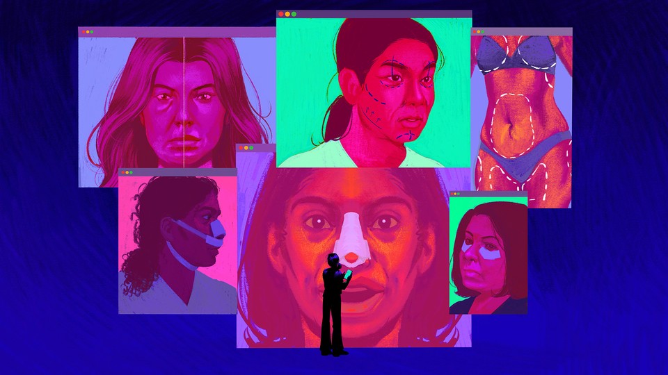 Illustration of social media screens with womens faces, pre and post cosmetic surgery.