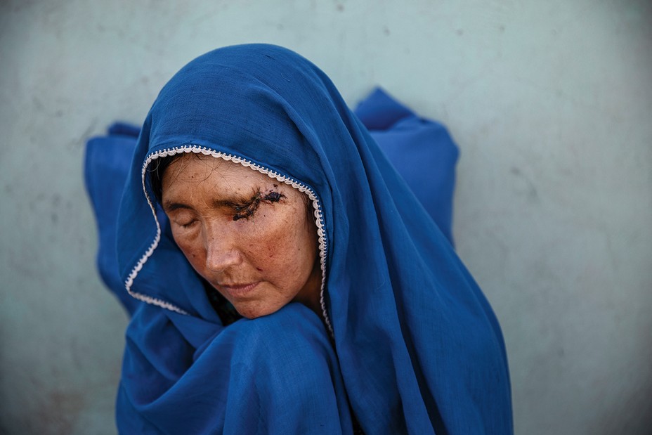 Woman in blue head scarf looks down, eyes closed, her left eye wounded and sealed shut