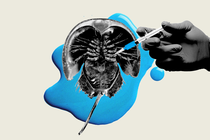 A gloved hand holding a syringe to a horseshoe crab carapace