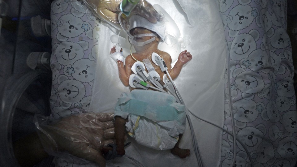 A premature newborn baby connected to medical devices