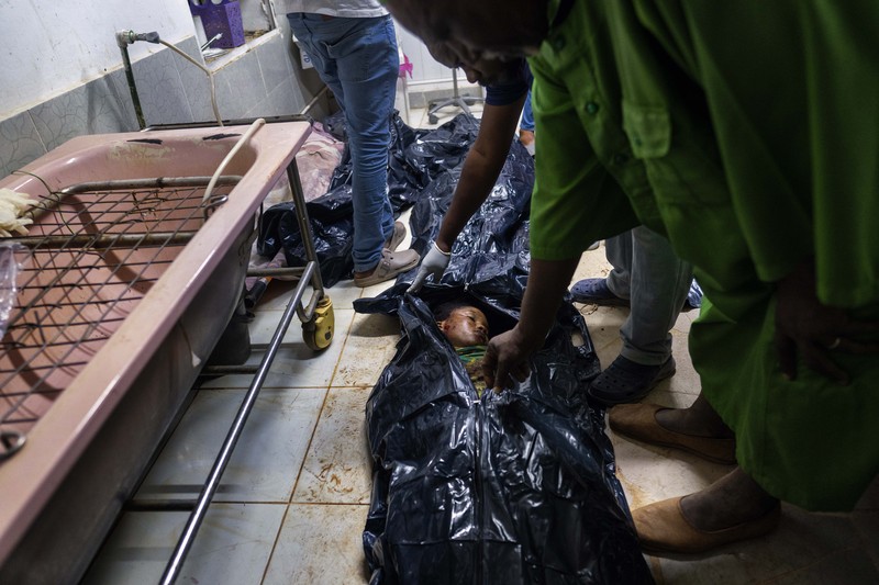 Officials examine a boy in a body bag. 
