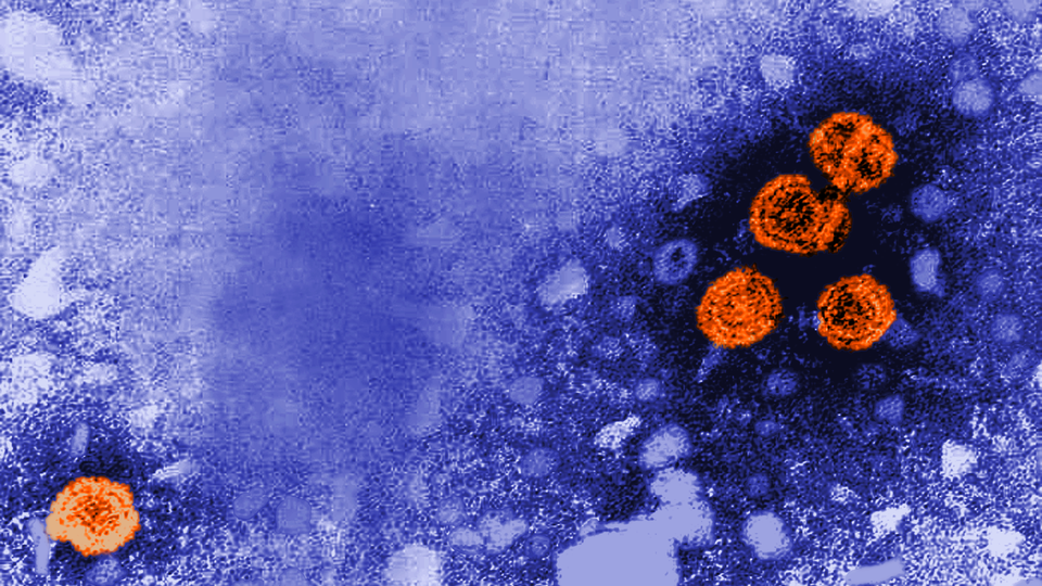 A microscope image of orange hepatitis B particles