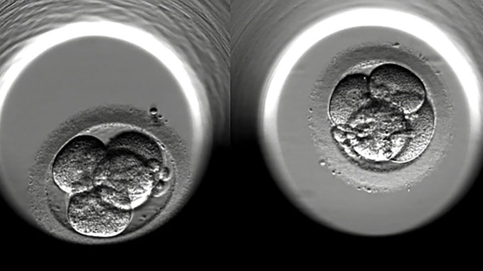 Embryos IVF