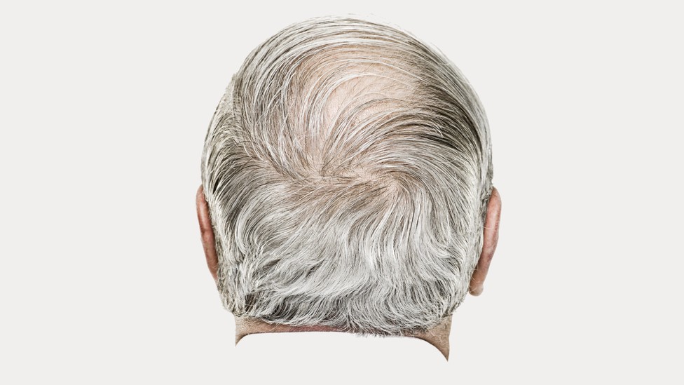 Elderly person