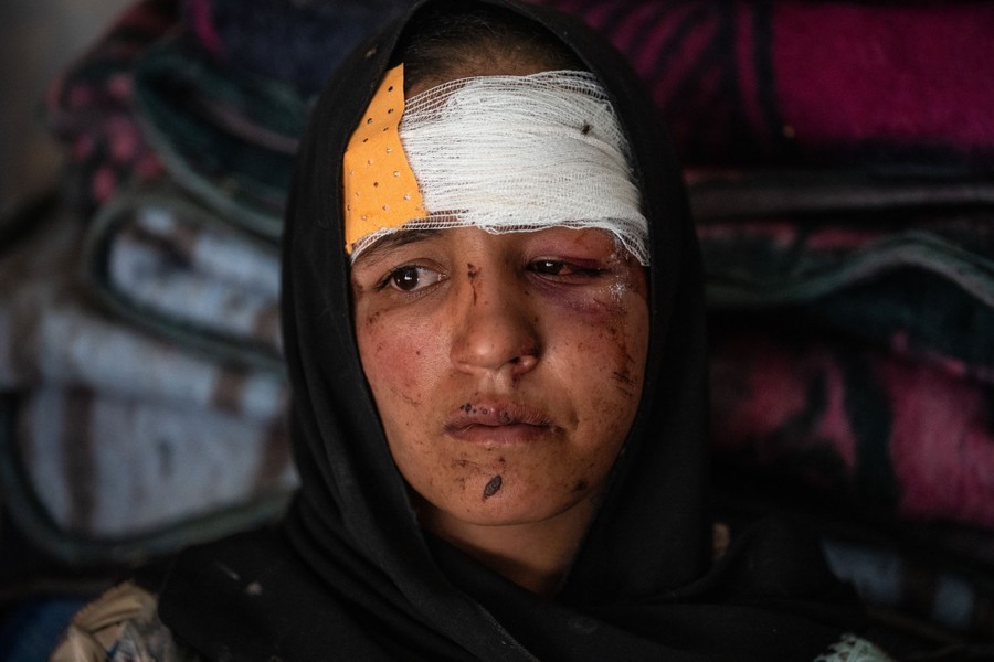 A close view of a woman wearing a bandage on her head. Her face has cuts, bruising, and some swelling.