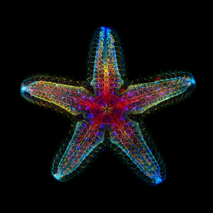 A microscopic study of a tiny sea star, showing its many branching nerves and other tissue in many colors.