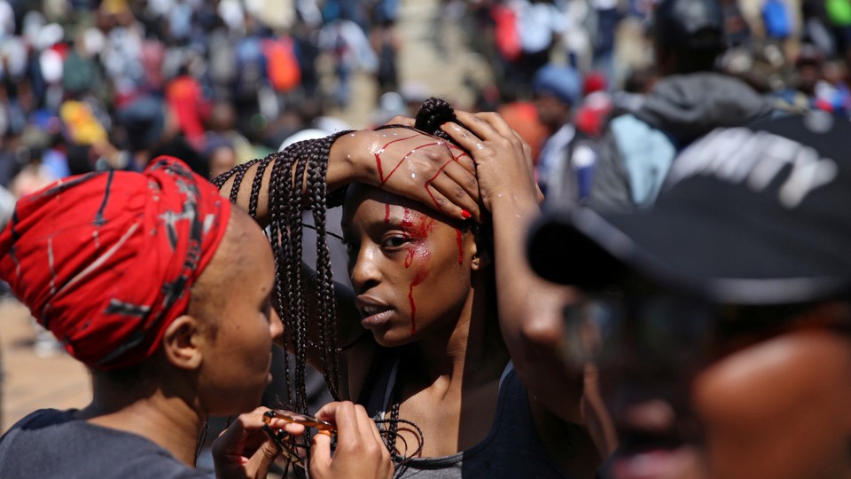 An injured protestor at University of the Witwatersrand in Johannesburg
