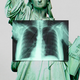 An image of the Statue of Liberty with an X-ray over her chest