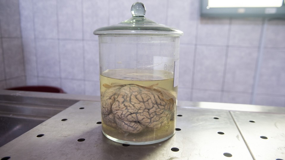 A human brain immersed in formaldehyde