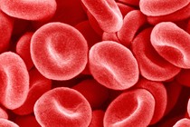 A microscopic-level photograph of red blood cells