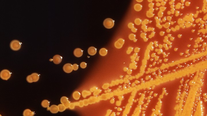 E.coli colonies