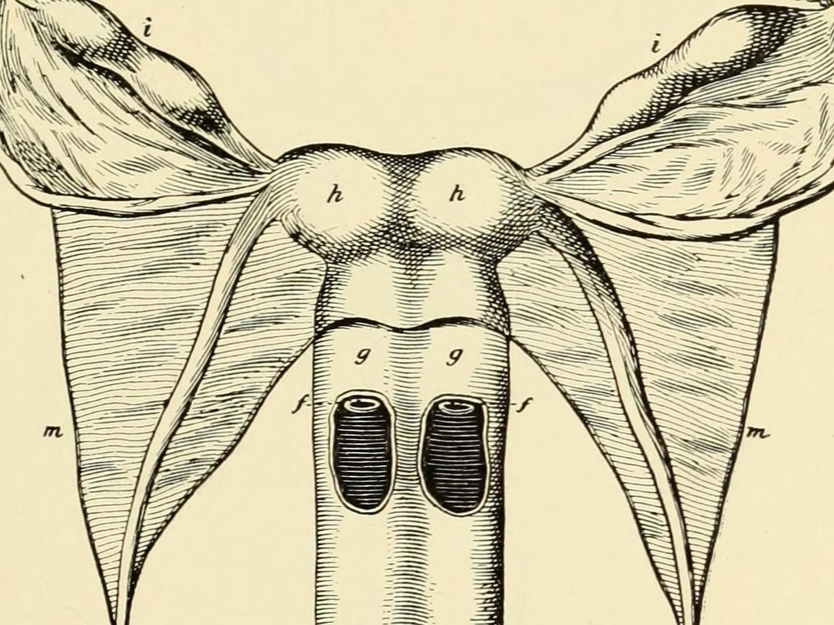 Woman With 2 Vaginas Pics
