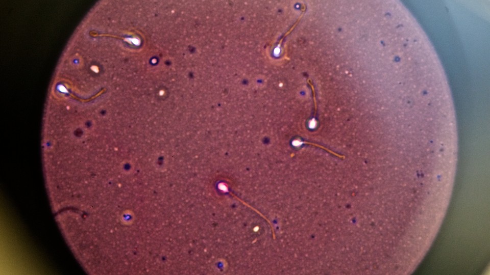 Sperm under a microscope against a red background