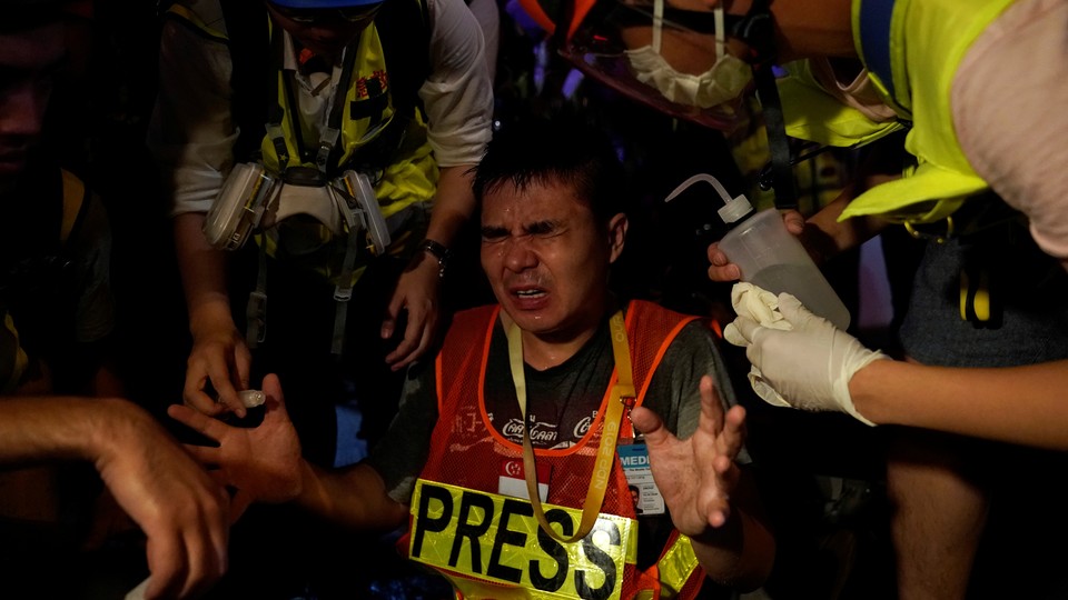 A journalist reacts in pain after being pepper-sprayed by police.