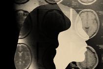 An illustration of a silhouette of a woman's face