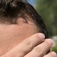 Close-up photograph of someone wiping their sweaty brow