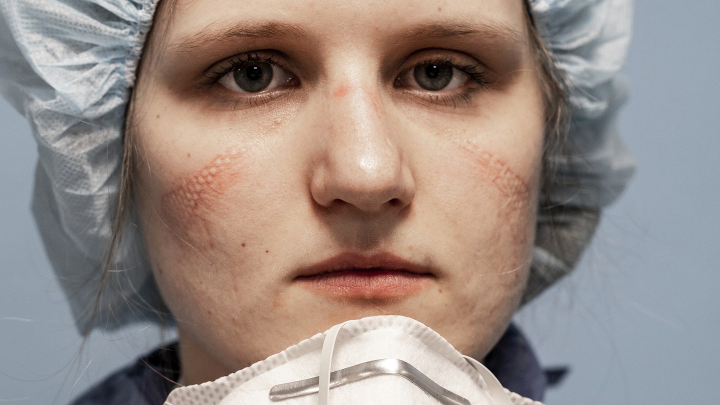 Italian health-care professional with face imprinted by mask