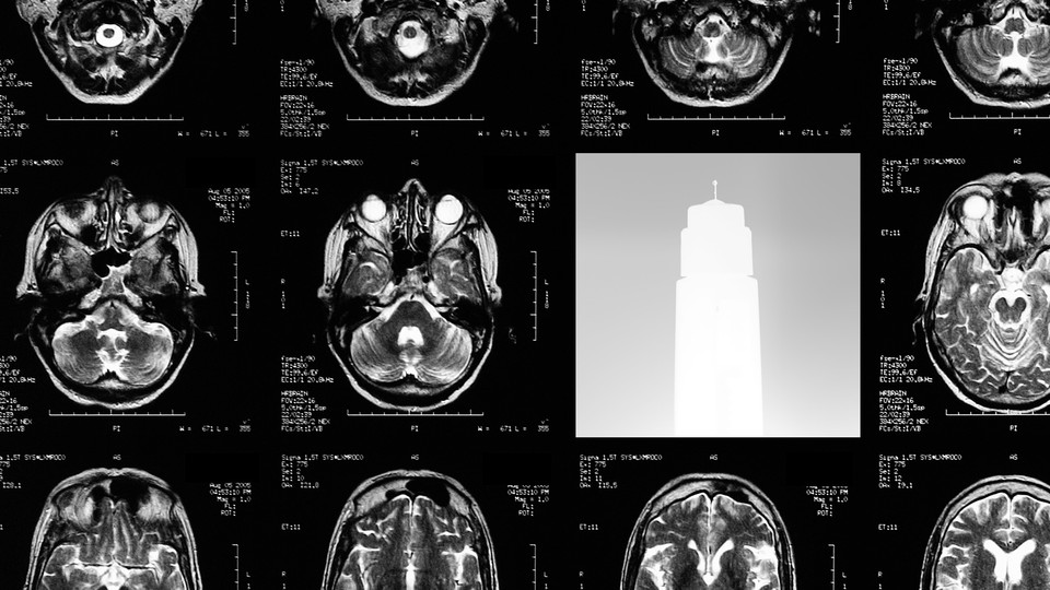 A series of brain scans interrupted by an image of a drug-injection pen