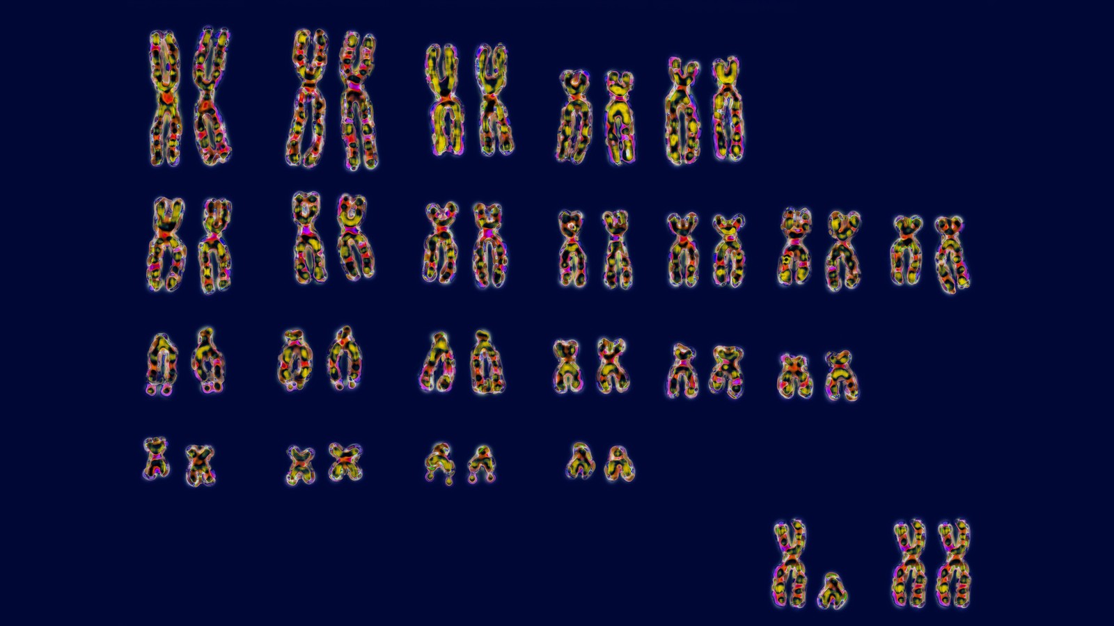 Men Lose Y Chromosomes As They Age The Atlantic