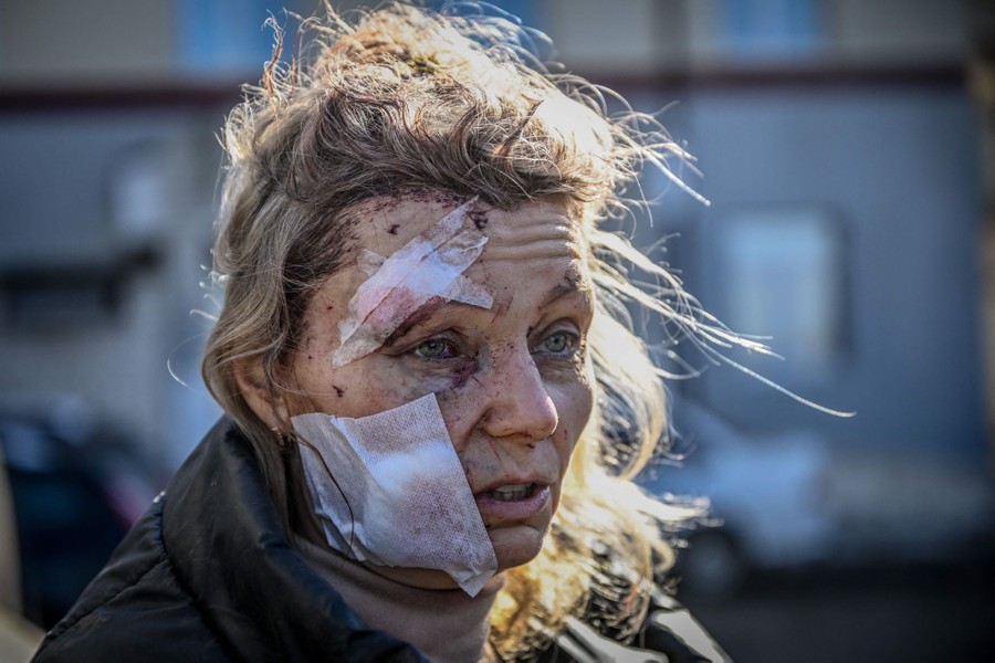 An injured woman, with dried blood and bandages on her face, stands outside a hospital.