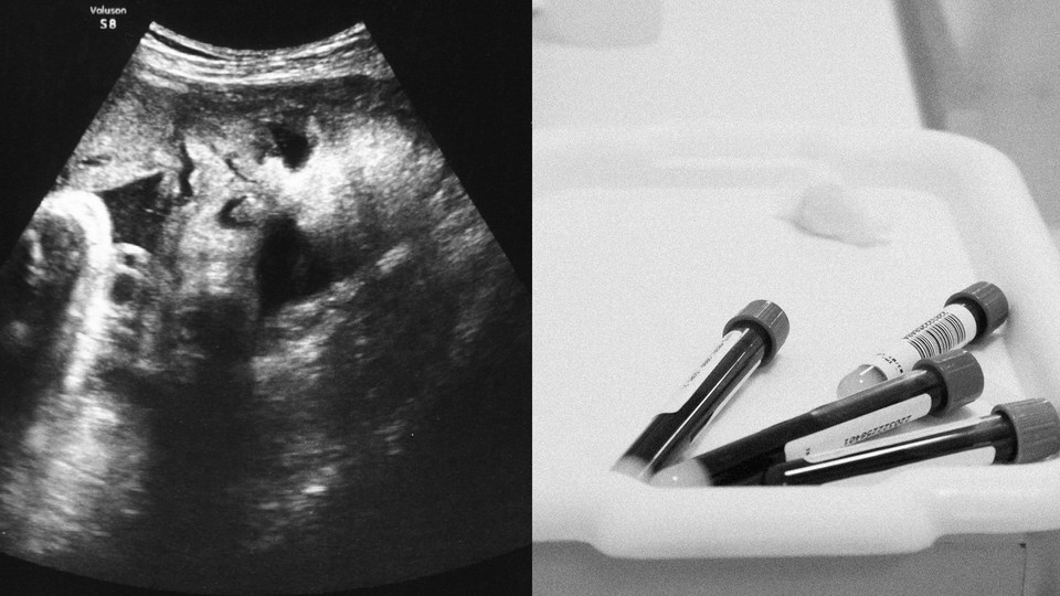 A pregnancy scan next to a photo of vials of blood