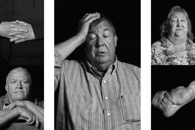 gif of multiple black-and-white photographs of lightning-strike survivors and scars