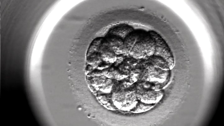 What Ivf Taught Me About The Abortion Fight The Atlantic