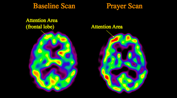 What Happens To The Brain During Spiritual Experiences The Atlantic