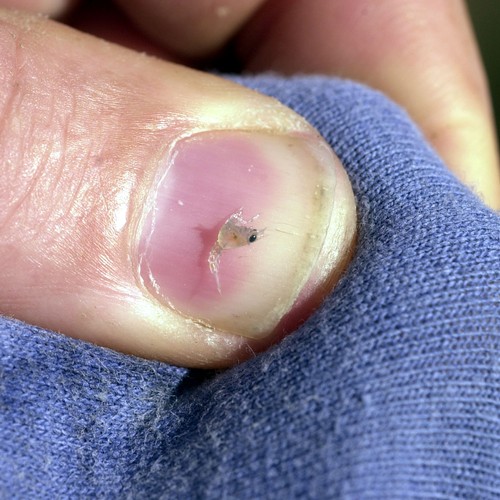 Poop Wrappers May Protect Baby Lobsters From Jellyfish Stings The Atlantic