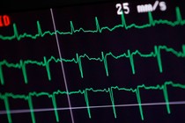 An EKG readout