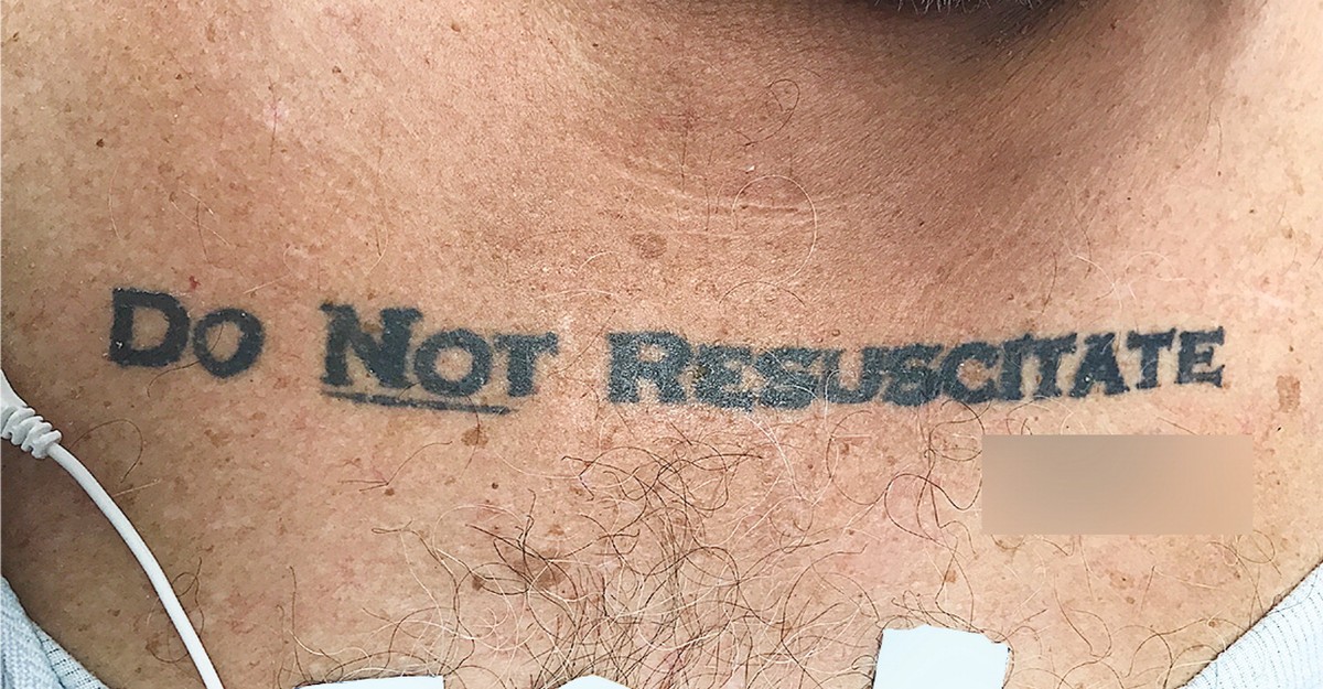 What to Do When a Patient Has a 'Do Not Resuscitate' Tattoo - The Atlantic