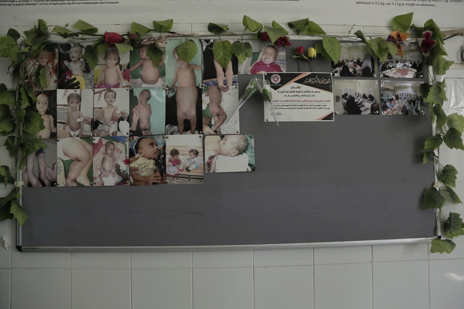 Photographs of severely malnourished infants hung on wall in the administrative office at the Aden Hospital, in Yemen, Feb. 13, 2018.