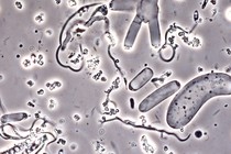 Nephromyces cells under a microscope.
