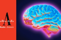 Multicolored image of a brain