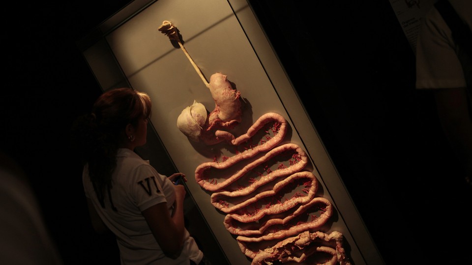 A plastinated human digestive system in a display case