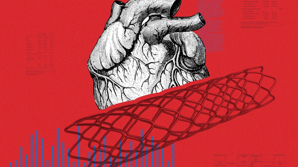 An illustration of a heart and a cardiac stent