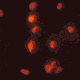 Red giardia