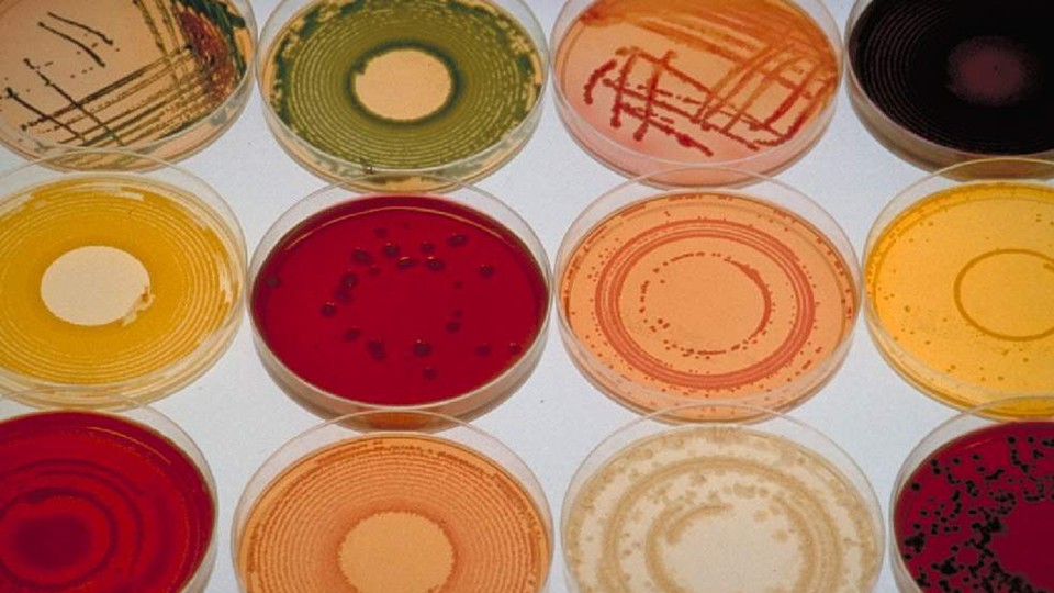 Bacteria cultures of different colors grown on petri plates