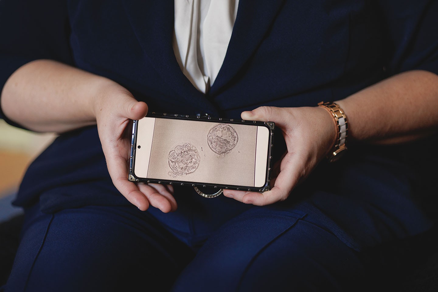 photo of woman's hands holding phone with image of two embryos as cells