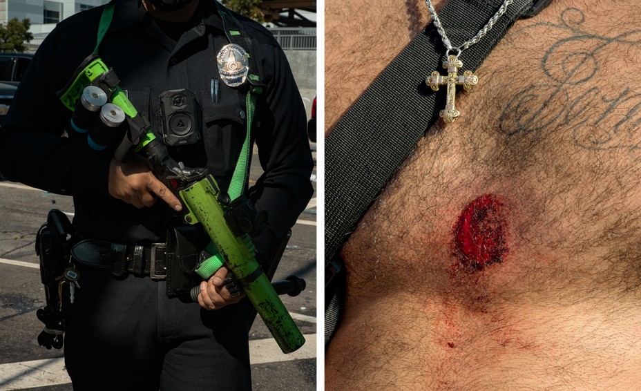 In a diptych there is a police officer holding a weapon and another photo of a bare chest with a bruise mark and a necklace