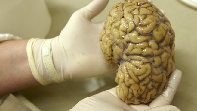 Scientists Partly Restore Activity in Dead-Pig Brains