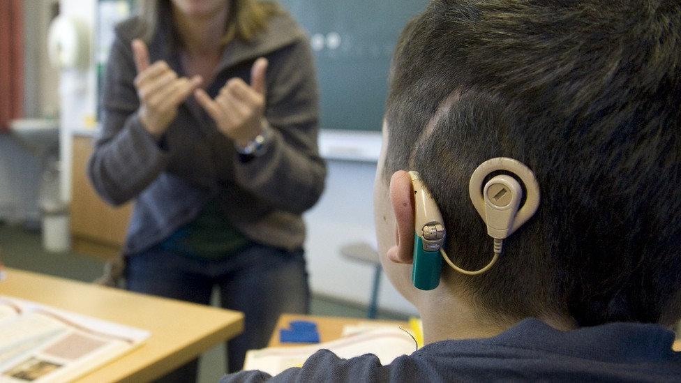How Cochlear Implants Allow the HearingImpaired to Live Between the