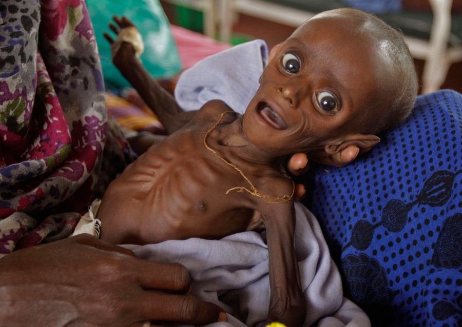 https://cdn.theatlantic.com/thumbor/YO2OA-DuvdlfkiOR8I501ji4X0A%3D/900x638/media/img/photo/2011/07/famine-in-east-africa/f01_26118117/original.jpg