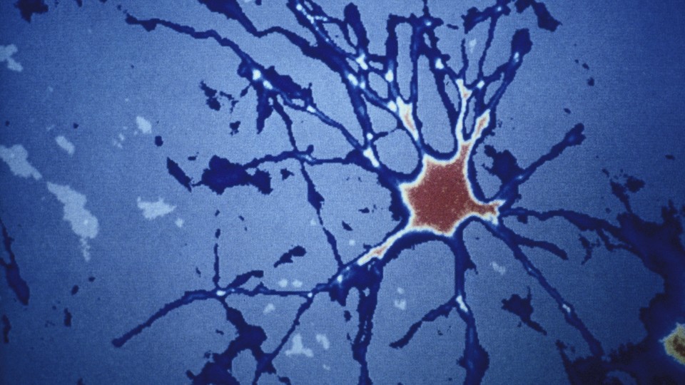 Blue and red human-brain cells