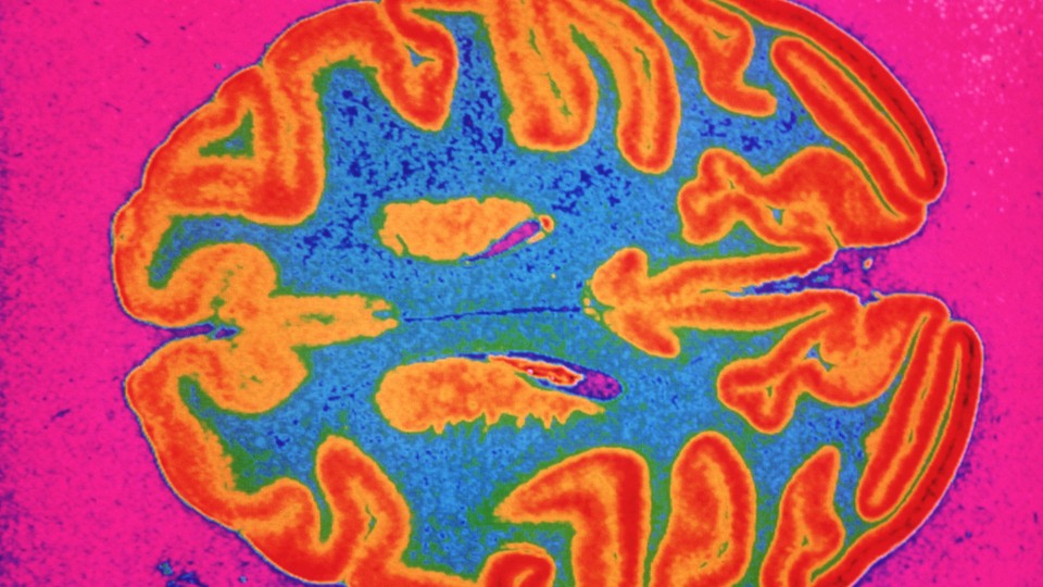 A multicolored scan of a brain