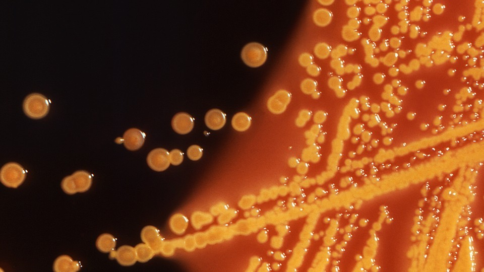 E.coli colonies