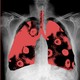 Chest X-ray with lungs highlighted