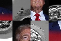Collage of Donald Trump and a black-and-white photo of a human embryo
