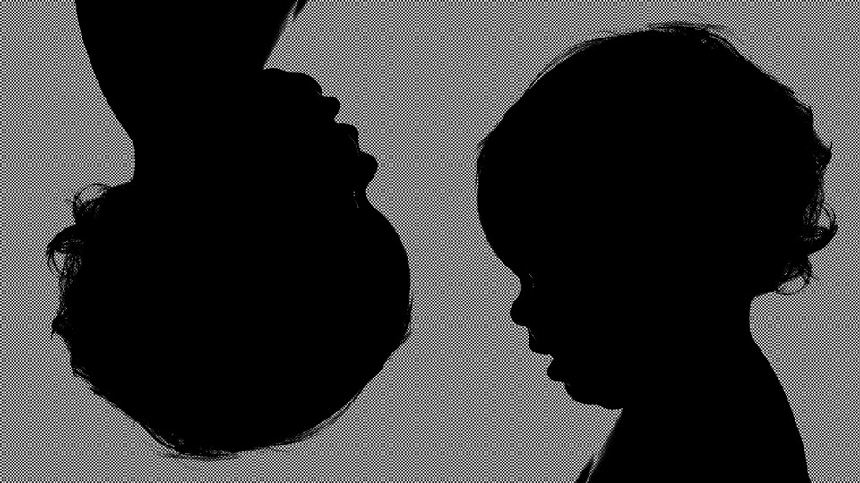 Silhouettes of babies' heads, one of which is upside down